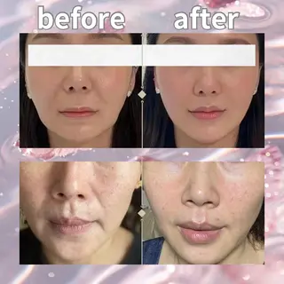 マツエク・マツパ 愛維美水光美肌専門店所属・愛維美水光美肌専門店 メンズレディースokのエステ・リラクイメージ