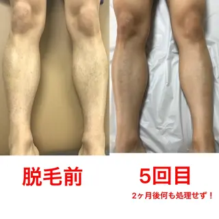 メンズ Beauty K's【ビューティーケイズ】所属・メンズ脱毛サロン ／金山昌弘のエステ・リラクイメージ