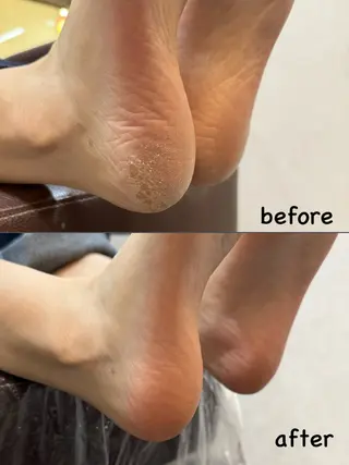 ネイル Acoonail 宮田のネイルデザイン