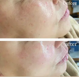 RE:moom リムーム/脱毛エステのエステ・リラクイメージ