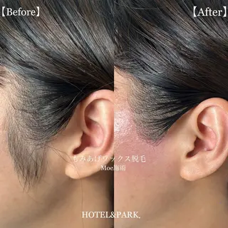 HOTEL&PARK .Moeワックス脱毛のエステ・リラクイメージ