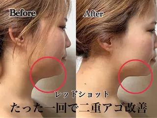 六本木脱毛andS さおりのエステ・リラクイメージ