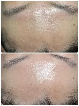 relaxation Stolzのエステ・リラクイメージ