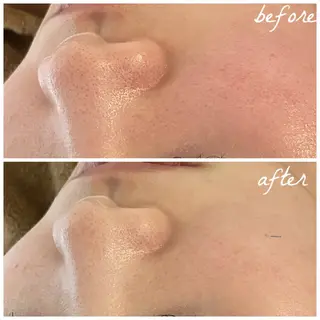 メンズ メナード岐阜茜部 杉浦のエステ・リラクイメージ