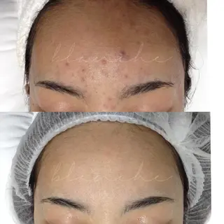 ロング カラー パーマ ヘアアレンジ ネイル マツエク・マツパ アイブロウ 都度払い肌質改善 &脱毛Blancheのエステ・リラクイメージ