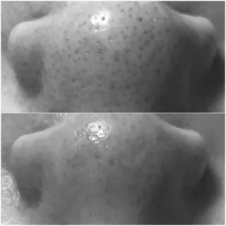 Chio-RE所属・Wax/絹肌艶肌🌼 坂結加のエステ・リラクイメージ