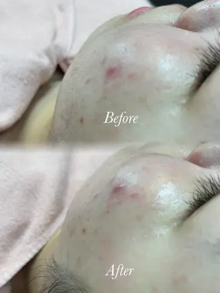 🫧美しい素肌へ🫧 今成柚乃のその他イメージ