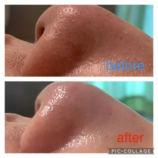 エステティックサロンアトリエホミィ所属・エステティックサロン アトリエ　ホミィのエステ・リラクイメージ