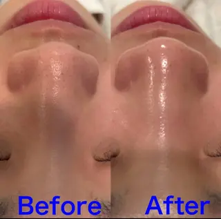 Fulala 永田のエステ・リラクイメージ