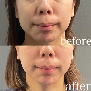 骨気&Relaxation vivian所属・VIVIAN 前田のエステ・リラクイメージ