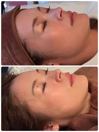 FLEUR🫧 フェイシャルのエステ・リラクイメージ