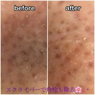 プレジール所属・ビューティサロン プレジールOTAKEのエステ・リラクイメージ