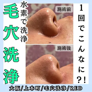 毛穴レス ハーブ＆ ワックス脱毛×光脱毛のエステ・リラクイメージ