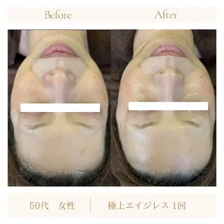 ラヴィエベル 中嶋のエステ・リラクイメージ