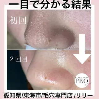 トータルビューティー サロンLilyのエステ・リラクイメージ