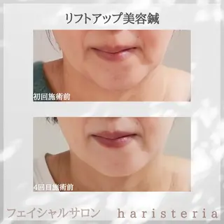 小顔・ツルツル素肌 ハリステリアのエステ・リラクイメージ
