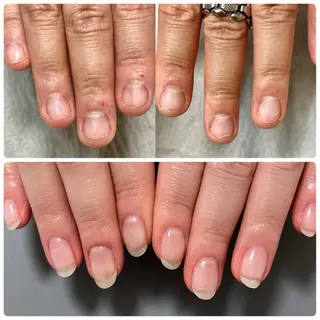 ネイル 京都桂/フィルイン /自爪育成/三品のネイルデザイン