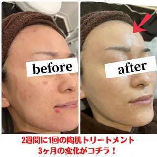 R-four🦋 土屋のエステ・リラクイメージ