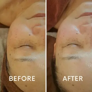 鍼灸サロンmiyabi所属・美容鍼×エステ　鍼灸 サロンmiyabiのエステ・リラクイメージ