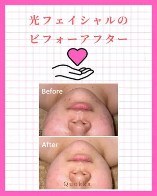 Quokka ✴︎ あま市甚目寺のエステ・リラクイメージ