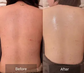 for woman所属・森 美優のエステ・リラクイメージ