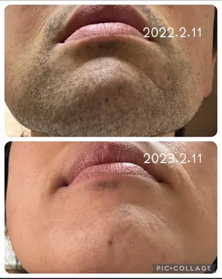 シマブクロ チカラのエステ・リラクイメージ