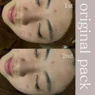 美肌salon GRAN CUORE所属・Natsuki🌙 GRAN CUOREのエステ・リラクイメージ