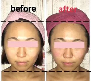 小顔プランナー辰巳 愛美のエステ・リラクイメージ