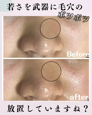 肌質改善サロン facialmoonのエステ・リラクイメージ