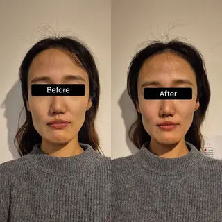 小顔矯正 LNのエステ・リラクイメージ