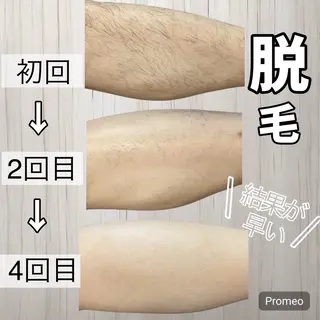 エステラボ　ei-B  王寺店所属・脱毛／脱毛 ／ボディメンテナンスのエステ・リラクイメージ