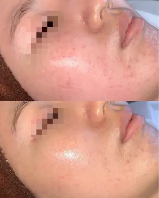 小顔|痩身salon miélu ミエルのエステ・リラクイメージ