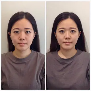 美容整体 小顔矯正 プラスフィール荒木のエステ・リラクイメージ