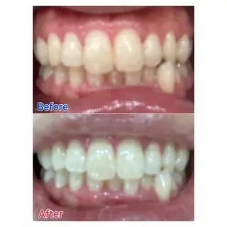 MBEAUTYSALON 千葉店・京成大久保所属・Melty 輝のその他イメージ