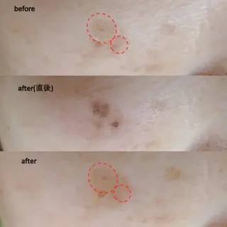  lafraise 田邉 里香のエステ・リラクイメージ