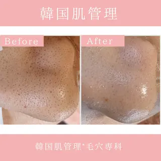 韓国肌管理 【毛穴専科】のエステ・リラクイメージ