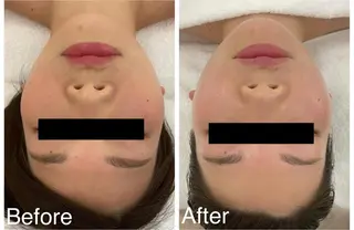 MIKI wellnessのエステ・リラクイメージ