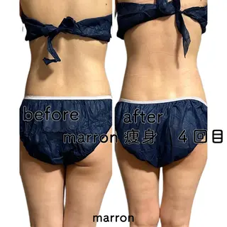 marron所属・痩身ハイパーナイフ ララピールリアボーテのエステ・リラクイメージ