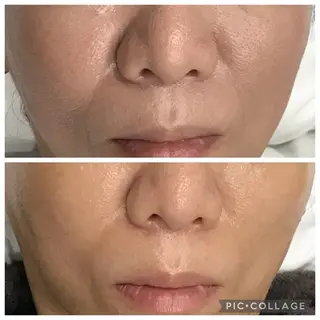 BeautePure naomiのエステ・リラクイメージ