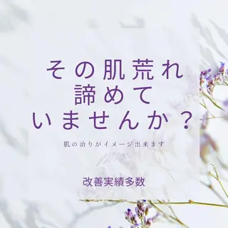 夏までに肌荒れ卒業 するサロン🌻のエステ・リラクイメージ