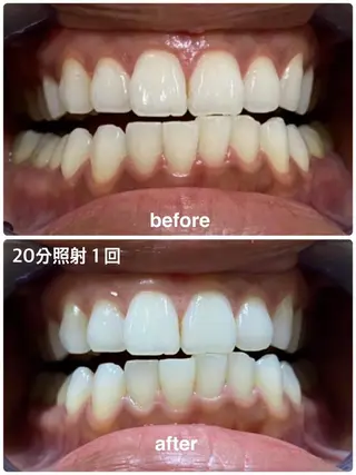 ホワイトニングジム 池袋のその他イメージ