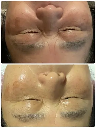 Salon Rion所属・Rion 野々村のエステ・リラクイメージ