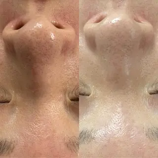 And I.所属・東向島eyelash And I.のマツエク・マツパデザイン