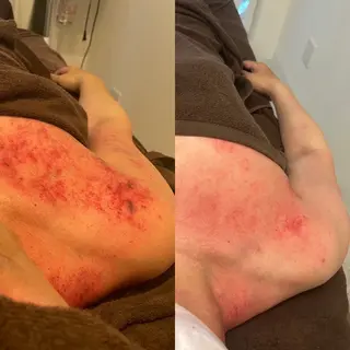 セルフエステエンリケ明石大久保店所属・夕希 毛穴と脱毛特化サロンのエステ・リラクイメージ