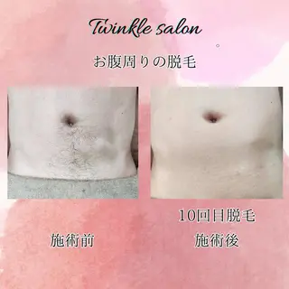 メンズ 中井 光明の眉毛・アイブロウイメージ