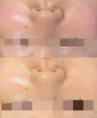 Nsが施術するサロン ナスサロ /Yuriのエステ・リラクイメージ