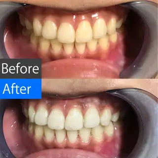 セミロング ヘアアレンジ メンズ アイブロウ マツエク・マツパ パーマ ネイル キッズ カラー 中目黒 ホワイトニングサロンのその他イメージ