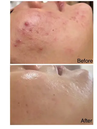 肌質改善サロン La Divinaのエステ・リラクイメージ