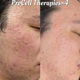 メンズ Blooming所属・LOUISE. ／肌質・頭皮のエステ・リラクイメージ