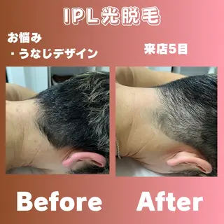 メンズ 効果重視脱毛サロンRICE所属・肌質改善/都度脱毛 Mahinaのエステ・リラクイメージ